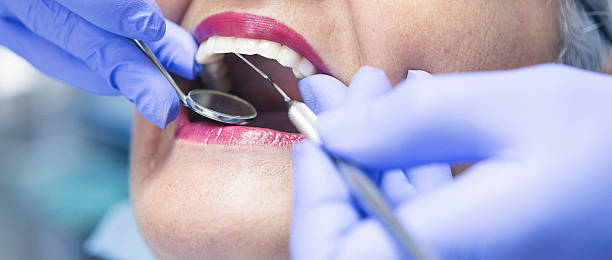 Best Emergency Dental Care for Abscessed Tooth in Hanna City, IL